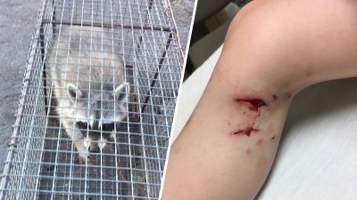 Tierno pero peligroso: mapache ataca y hiere de gravedad a niño ...