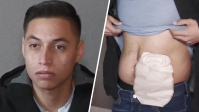Joven hispano vende tamales para pagar una costosa operación por el agrandamiento de su colon