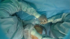 Hospital del sur de Florida hace historia al operar a bebé dentro del vientre