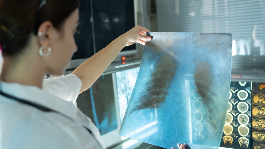 Woman radiology doctor examining chest x-ray film of patient in health care medical laboratory at hospital