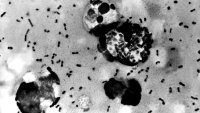 This Centers For Disease Control (CDC) file image obtained 15 January, 2003, shows the bubonic plague bacteria taken from a patient. The FBI said 15 January it had found several vials of the bacteria that could cause bubonic plague which had gone missing from the Texas Tech University Health Sciences Center in Lubbock, Texas. "We have accounted for all those missing vials," said Lupe Gonzalez, the FBI special agent in charge of the investigation. The bacteria had gone missing from the  where it was being used in a study of antibiotics.  AFP PHOTO/CDC (Photo by CDC / AFP) (Photo by -/CDC/AFP via Getty Images)